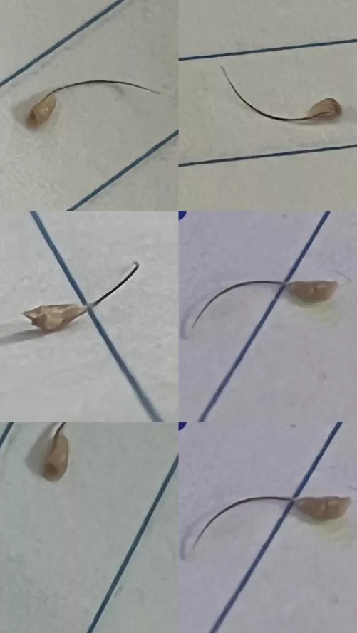 Hairy Houdini the Magic Hair Folicle