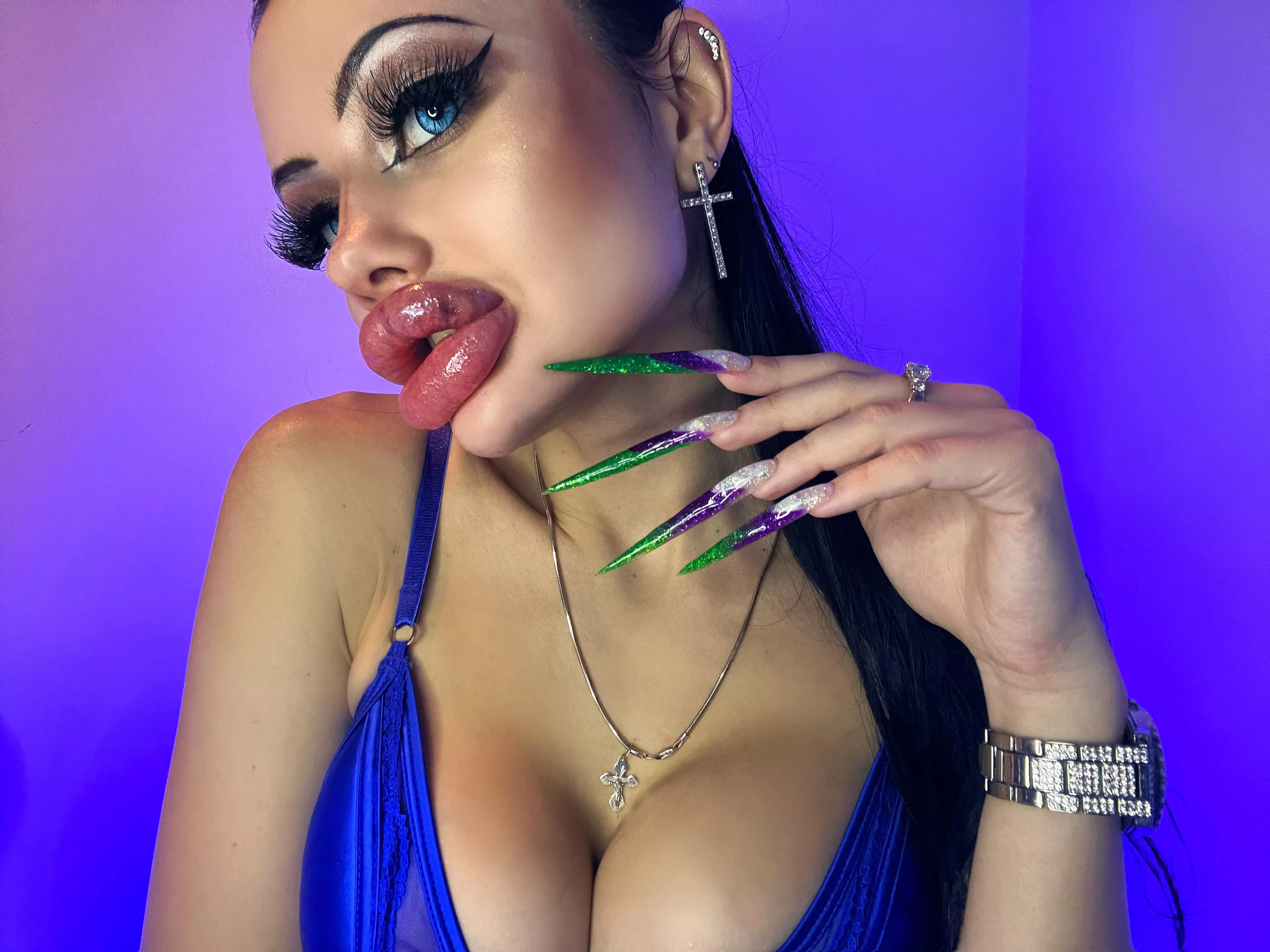 My biggest swollen lips 👄