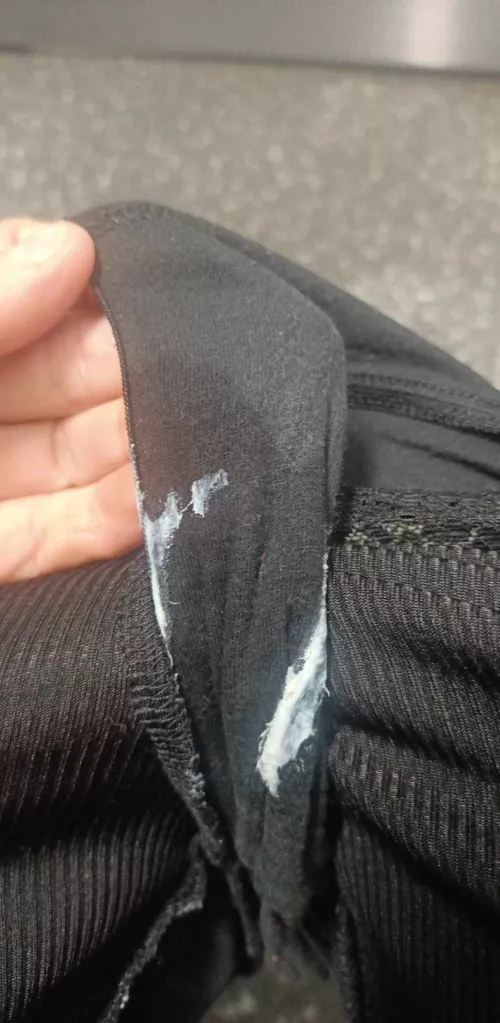 Oh dear what happened here 🙊