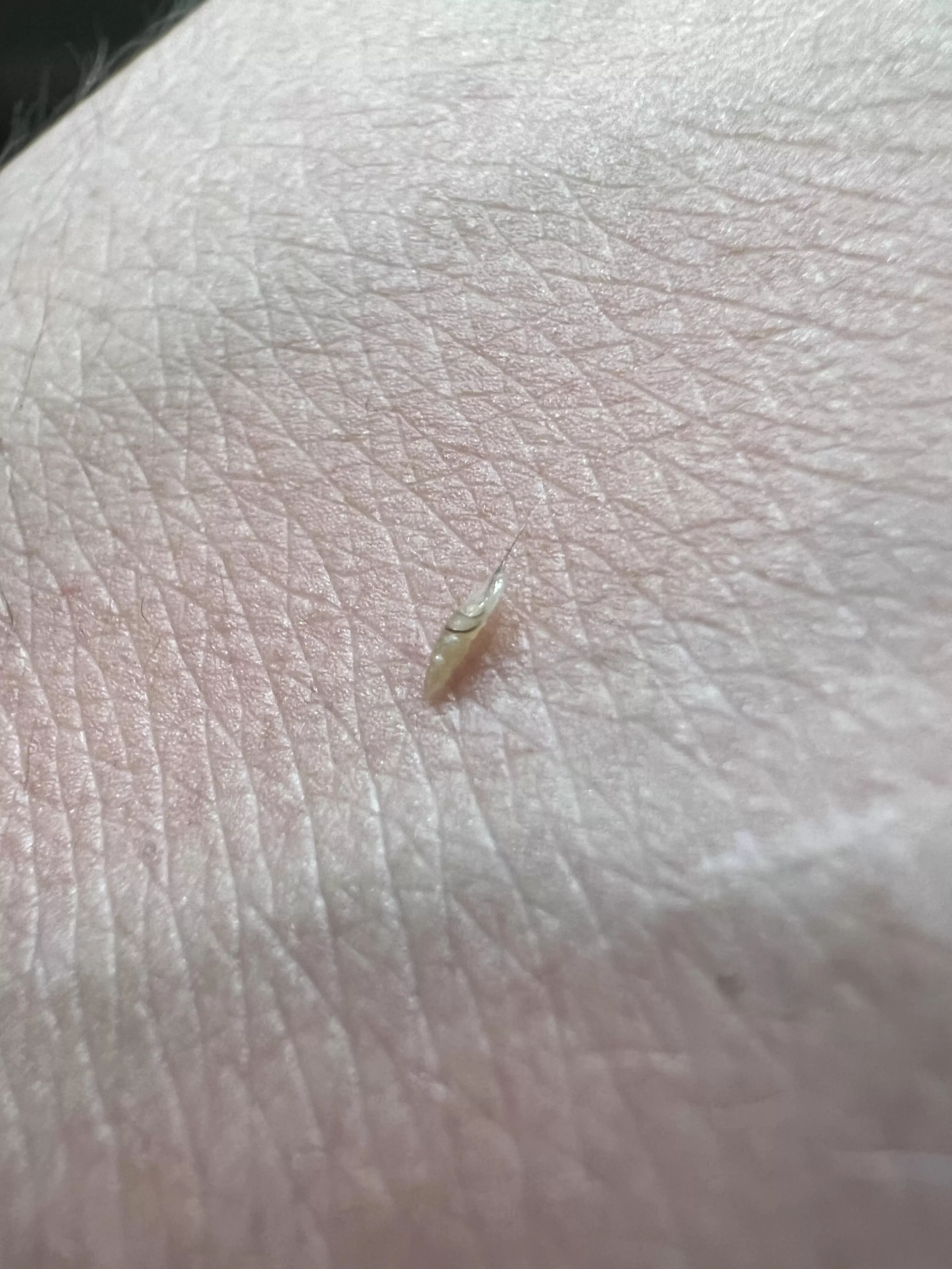 Sorry no video, but this fella was buried on my stomach