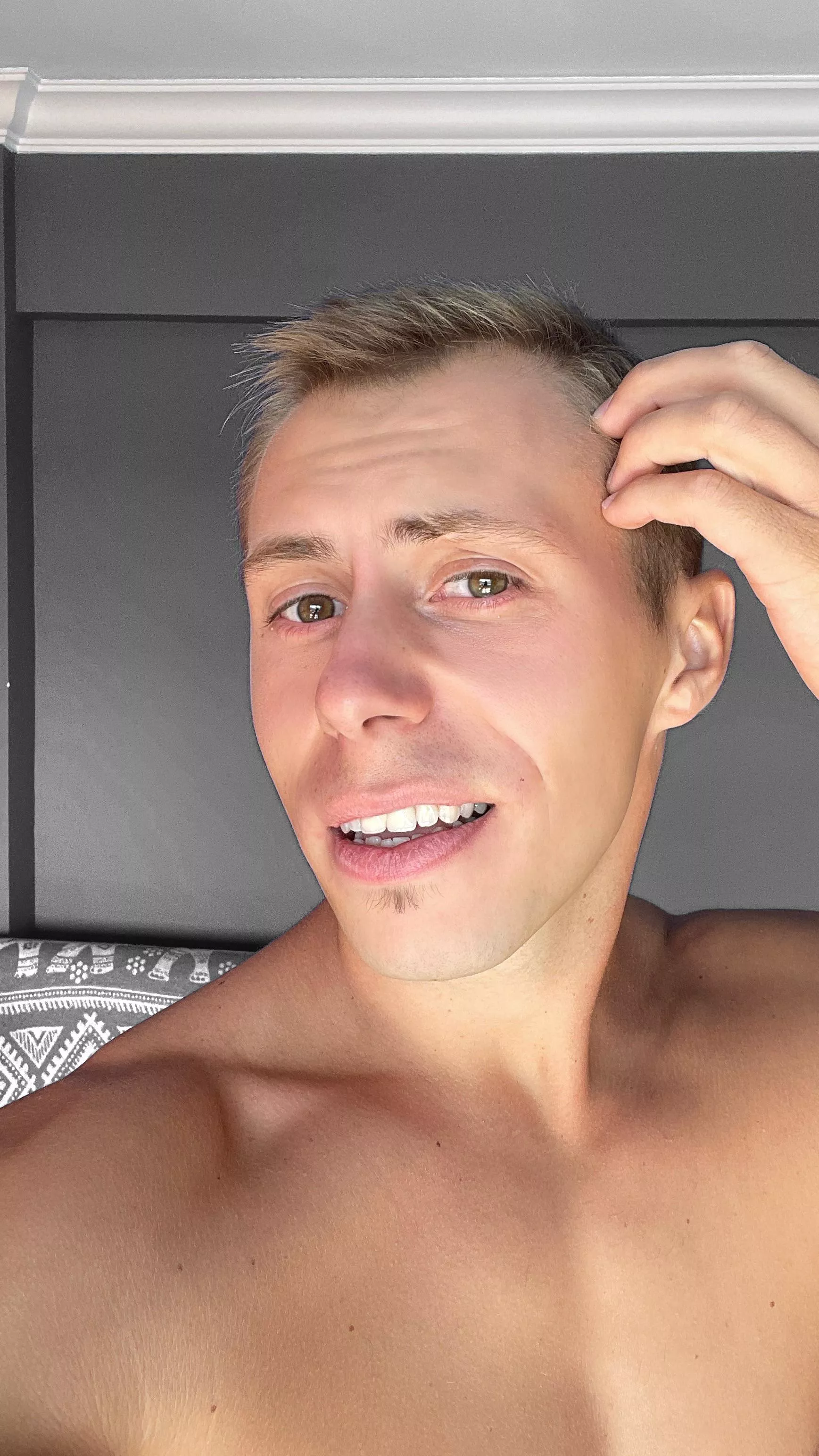 Who is also unlucky with the hairline ? Who is also unlucky with the hairline ?