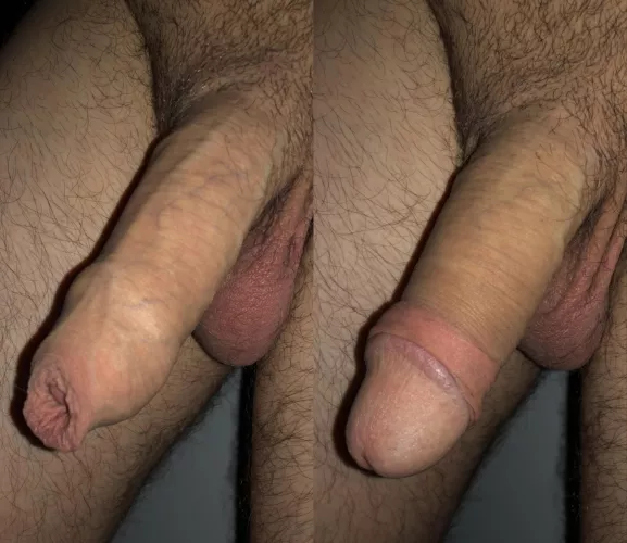 Left or right?