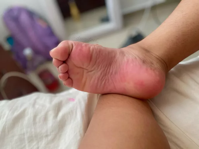 Note to self: don’t write someone’s name on my feet with markers or else I’ll have stained soles😂