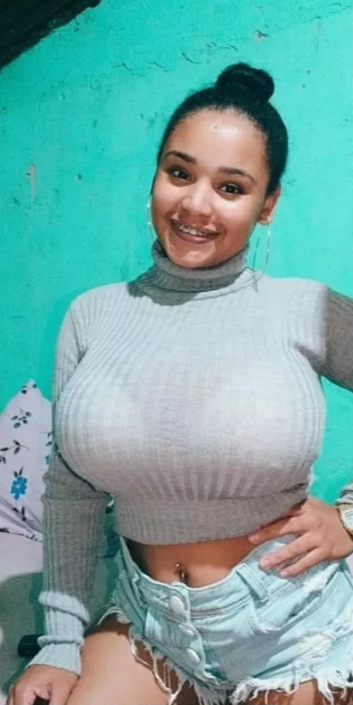 Tortleneck will hide them of course