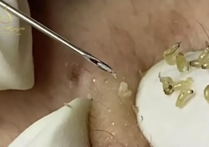 I got a fun message -- love you too blackhead 🙏🏻