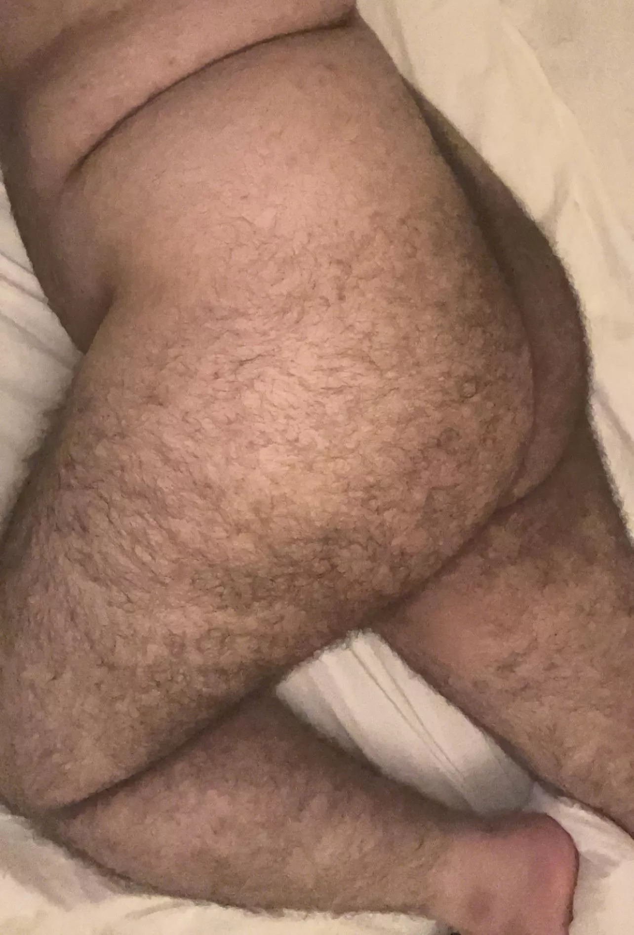 (20) is it too hairy?