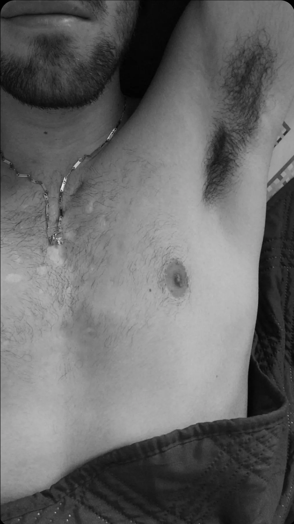 [24] Black and white