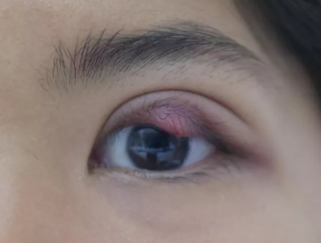 2am - tempted to pop XL stye!