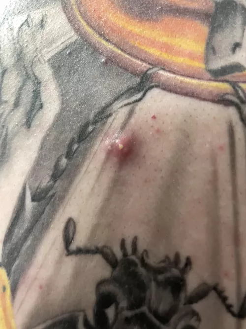 His back, before the pop