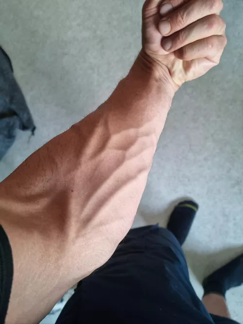 Vein action