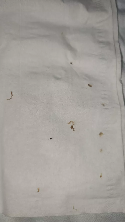 Wife attacked my back tonight. Blackhead/Cyst