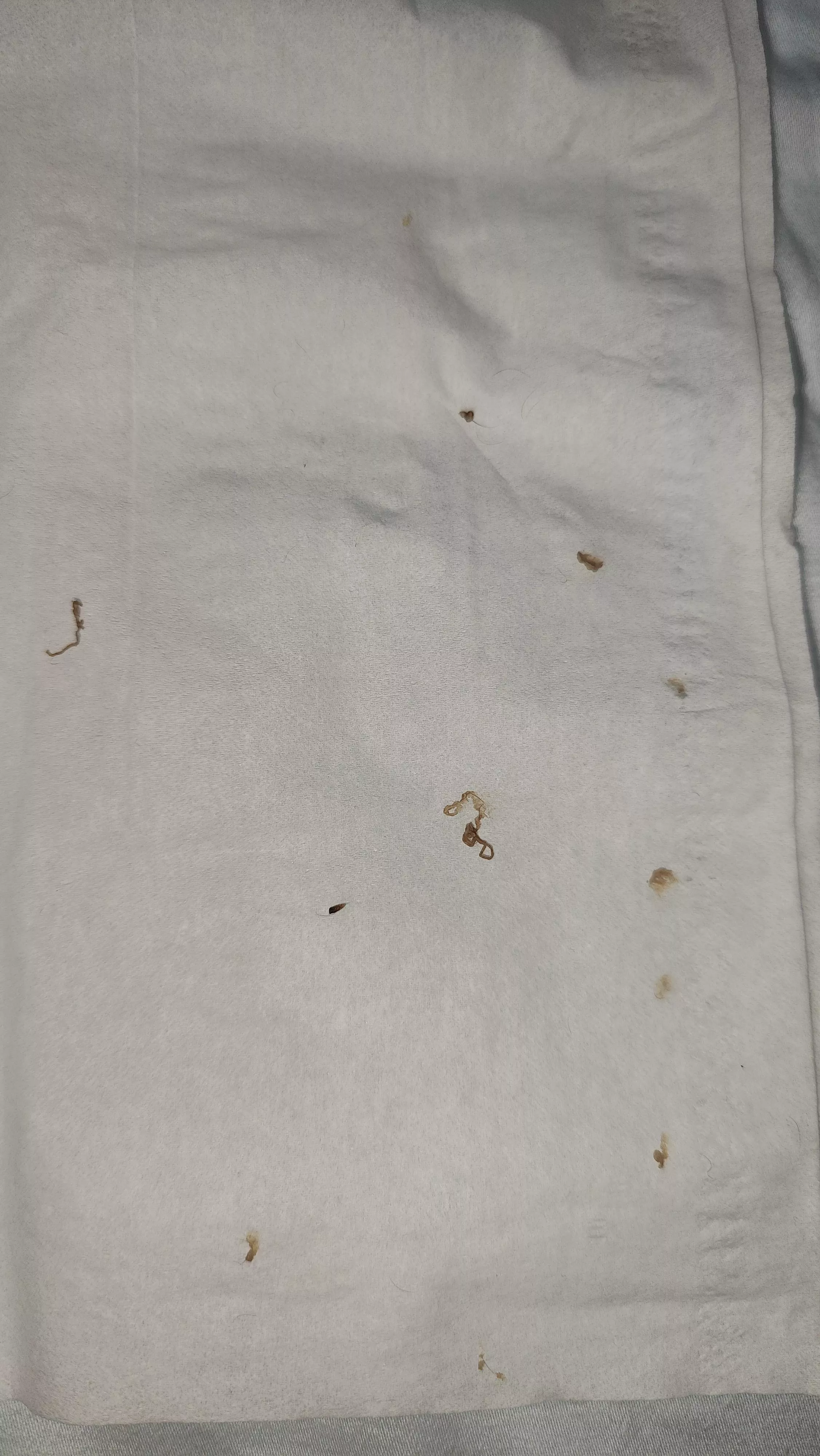 Wife attacked my back tonight. Blackhead/Cyst