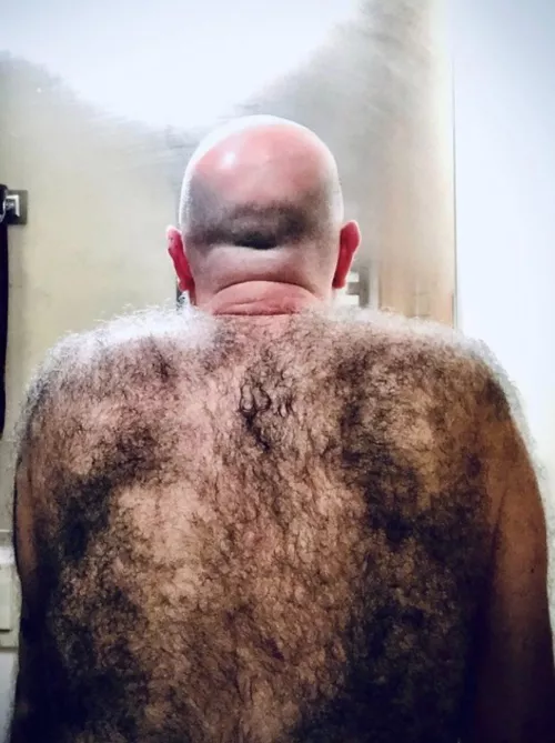 Insanely hairy back
