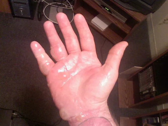 OC, but old (2006ish). Was looking for another picture, when I found this. Don’t drink and pan-fry frozen egg rolls!