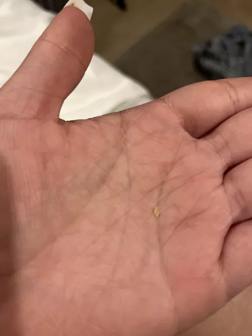 had the urge of scratching my scalp. This came out