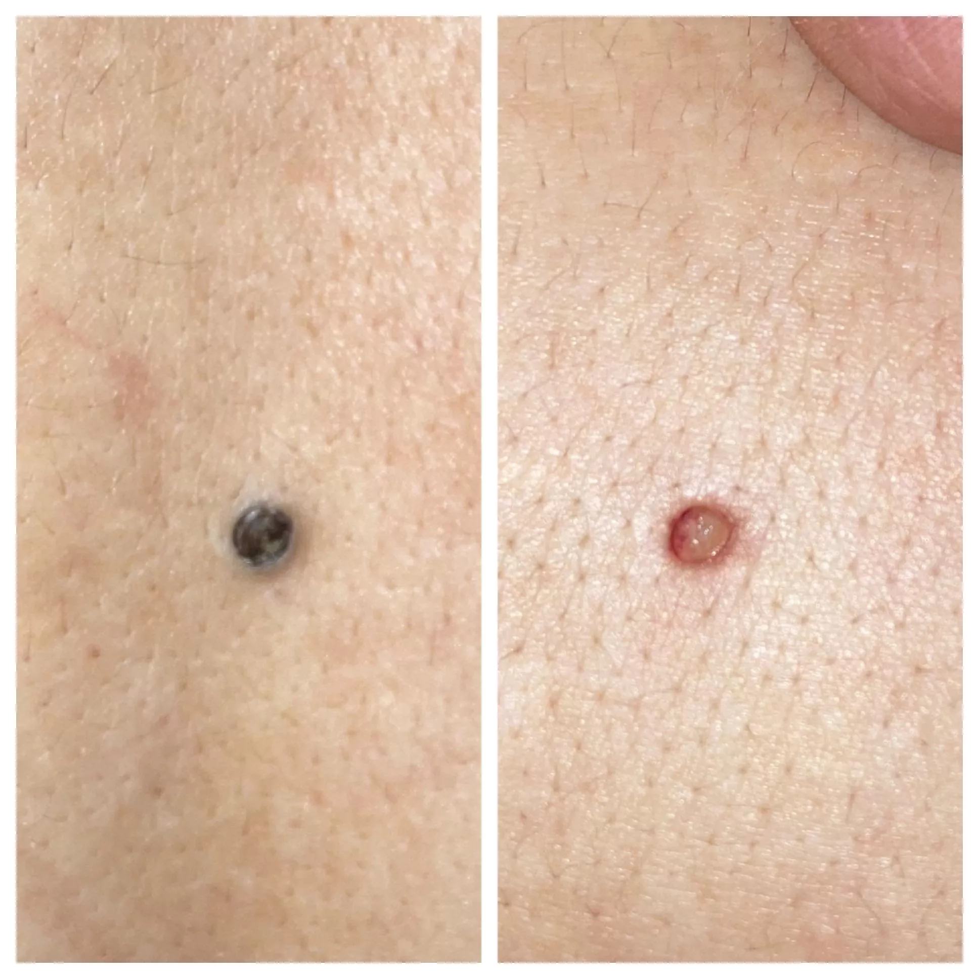 Stupid Pore of Winer—!