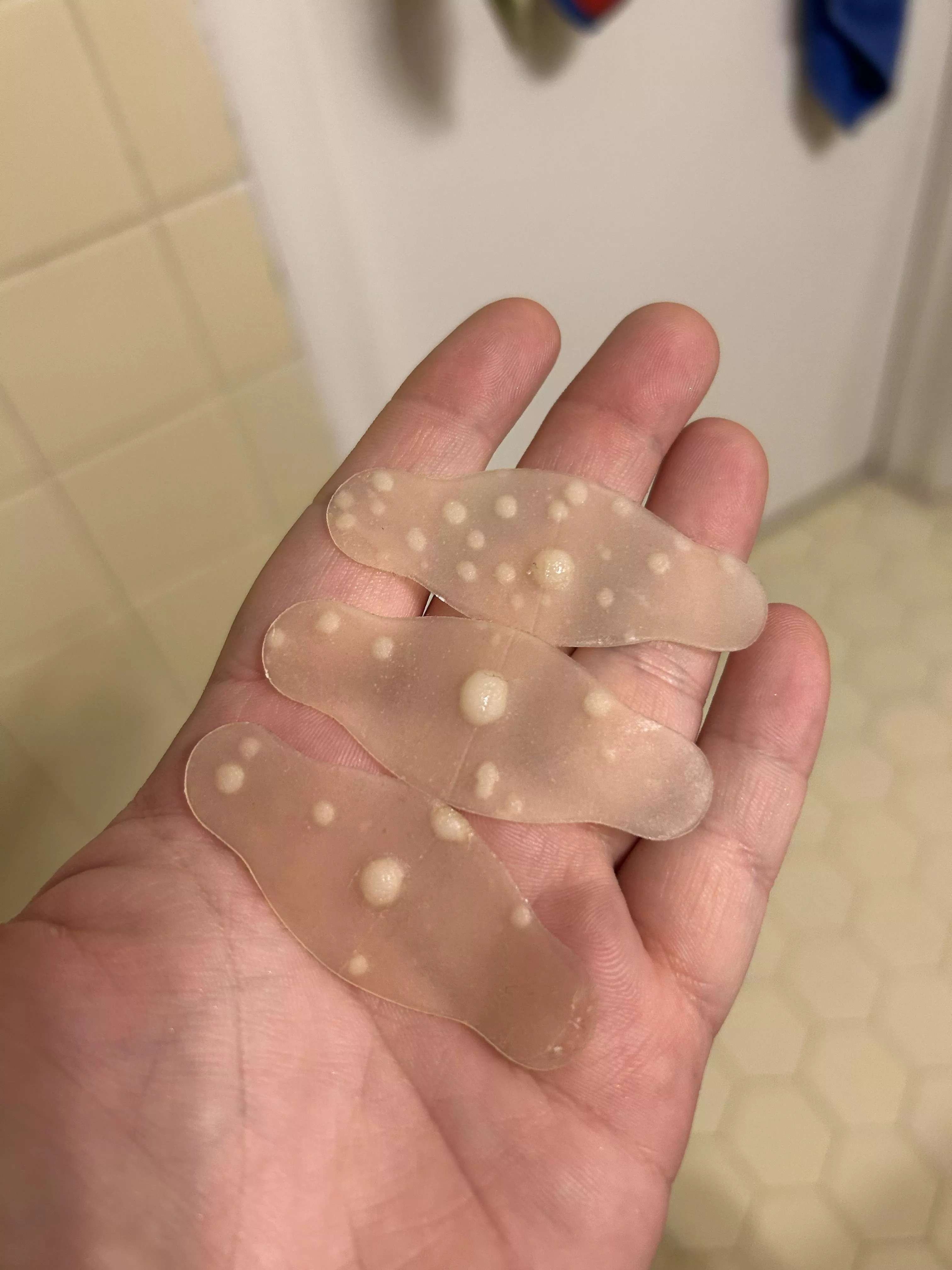 Used some Hydrocolloid patches on my HS flare up - great success!