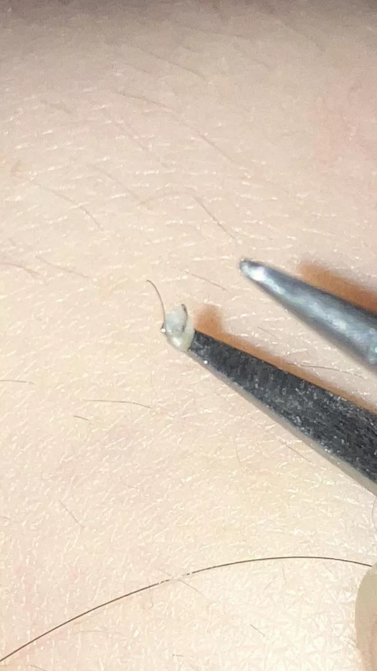 First post! Nice lil thing on my bikini line, didn’t record because self conscious (plus, I’m 17)