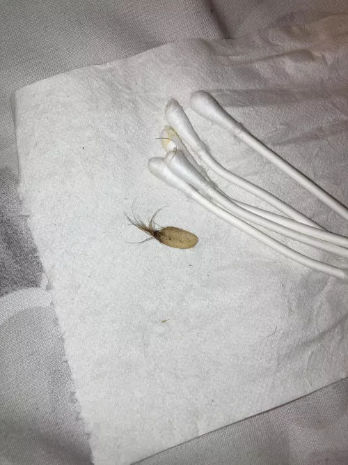 Yanked this from my belly button