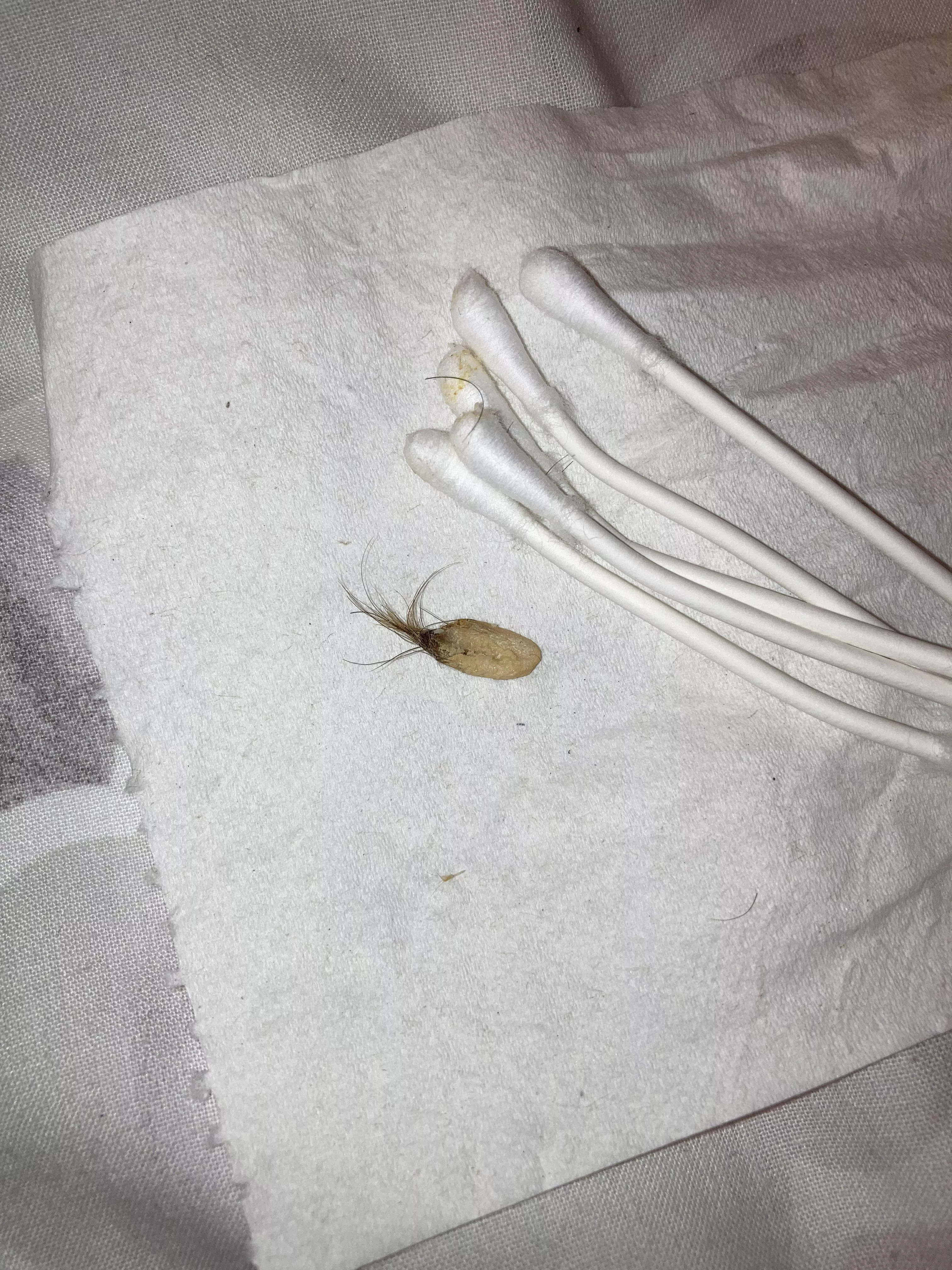 Yanked this from my belly button