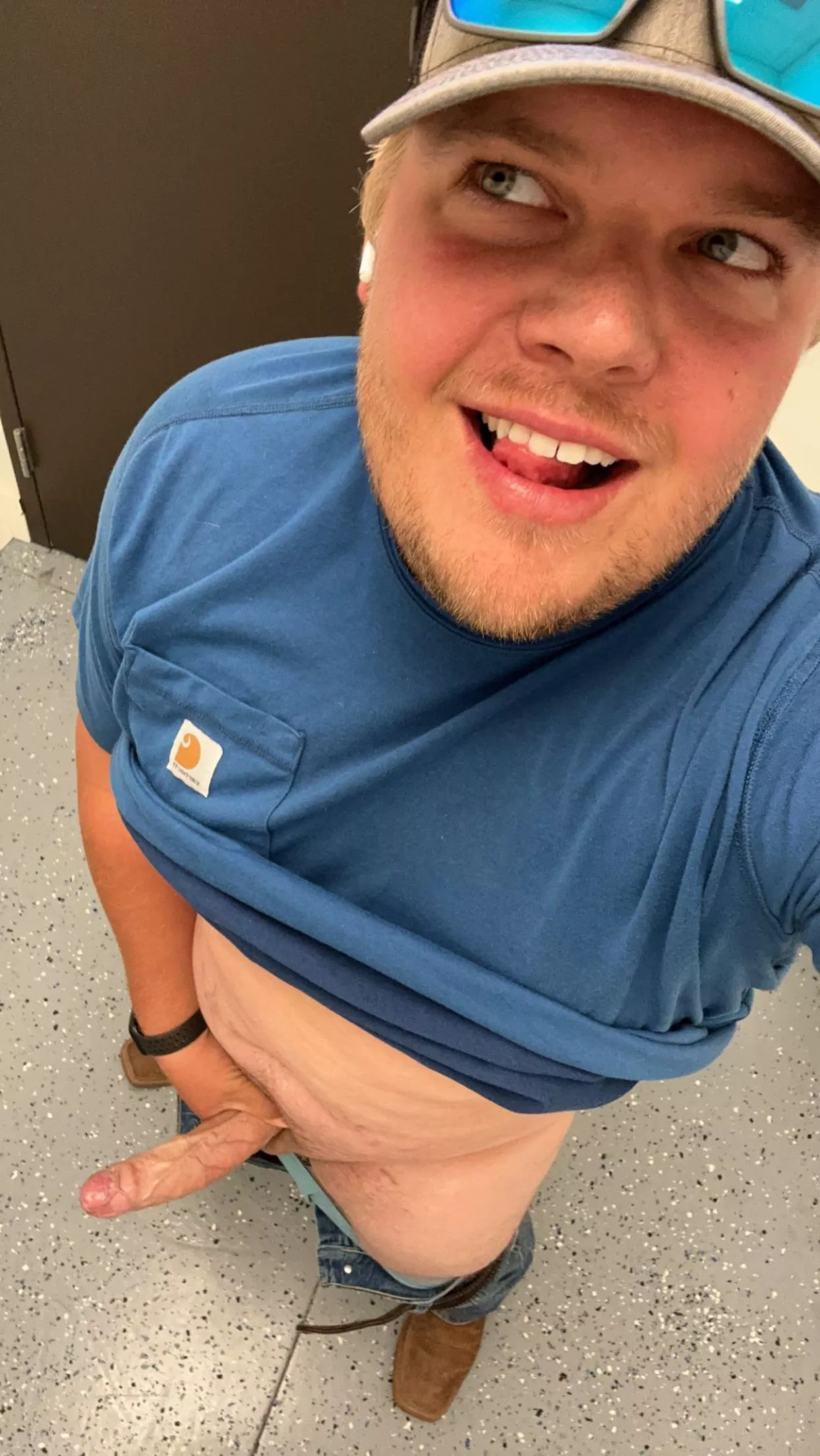 Are stretch marks okay?