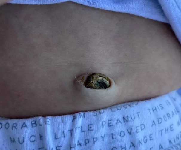 Forbidden Pop: umbilical cord