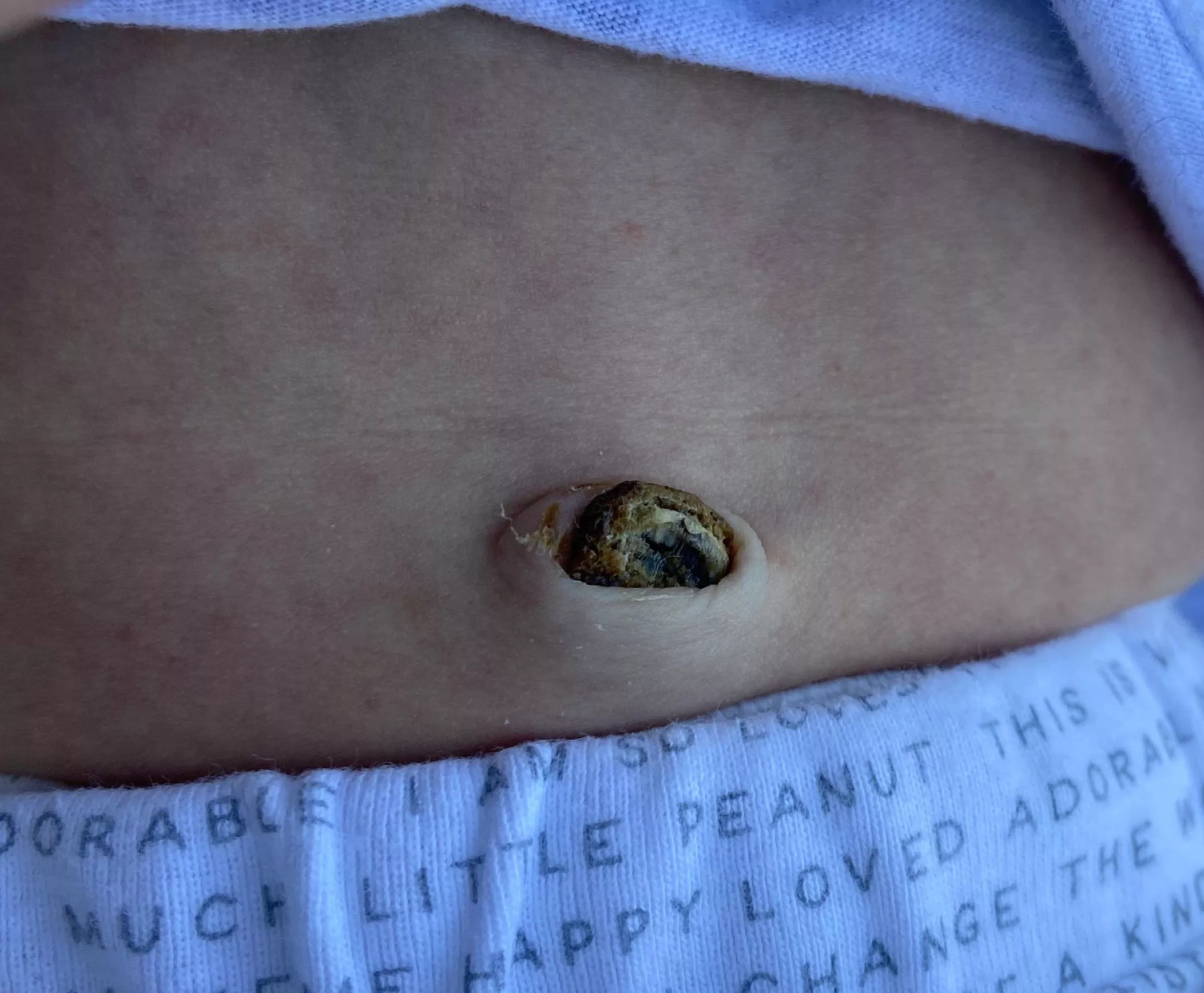 Forbidden Pop: umbilical cord