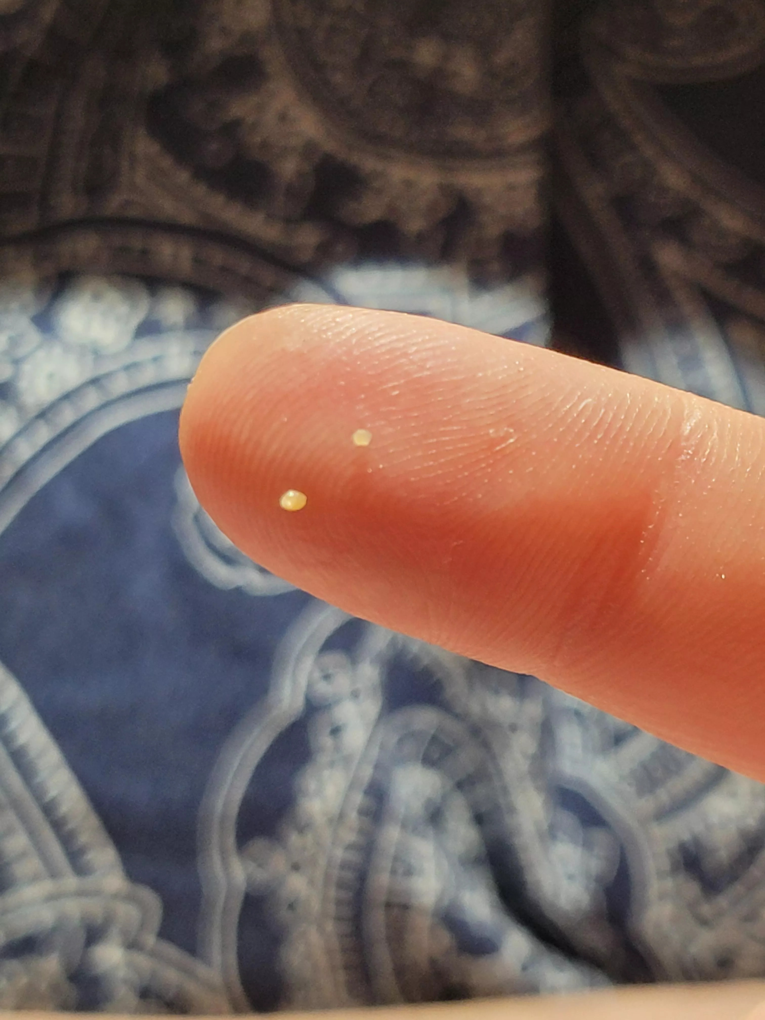 Little blackhead dudes from my ear.