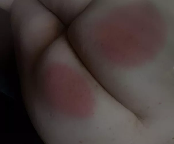 Is my ass red enough?