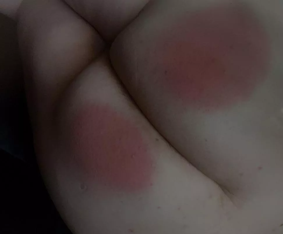 Is my ass red enough?