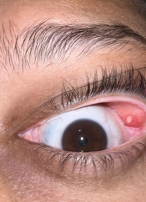 Posting again without asking questions