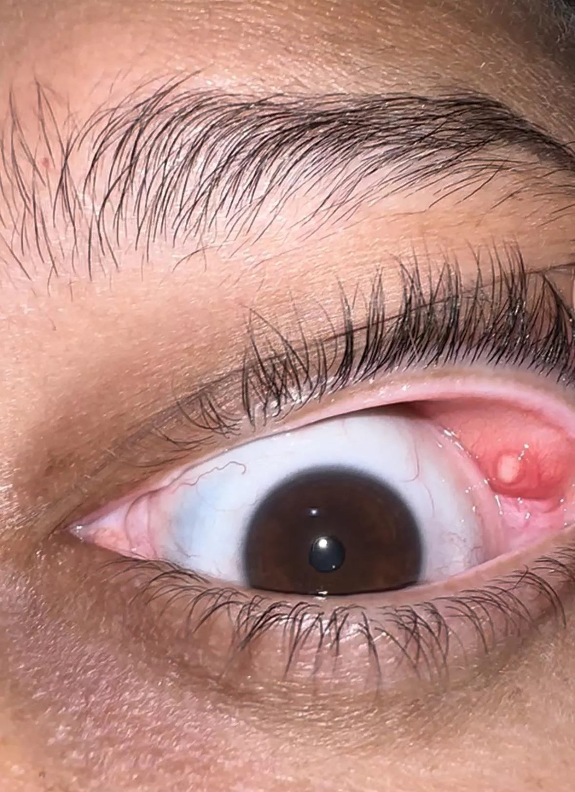 Posting again without asking questions