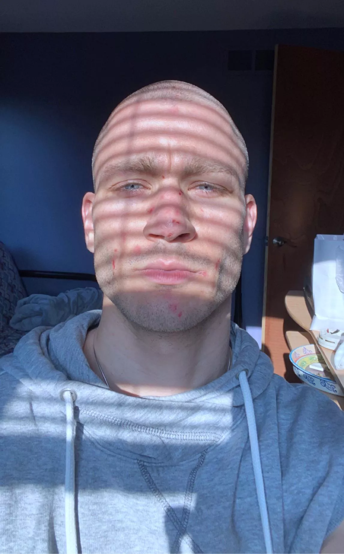 Trigger warning. Blue eyed stare