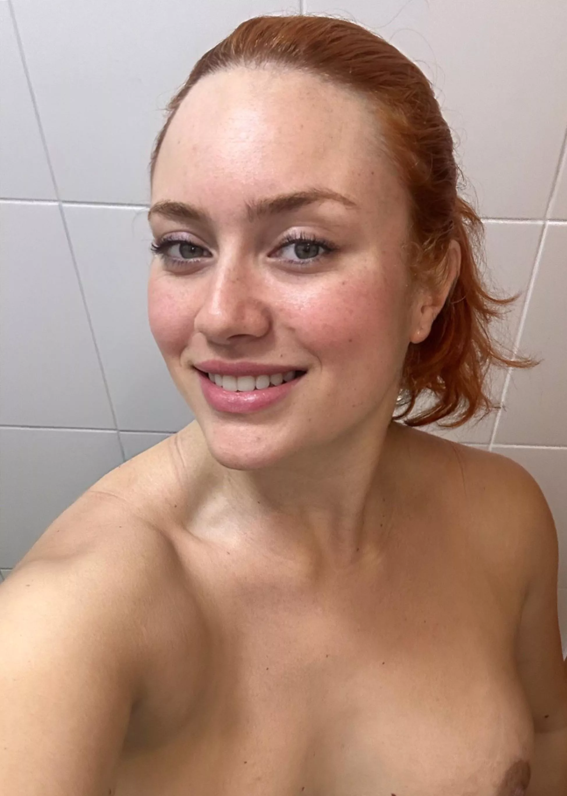 My freckles are all over my body