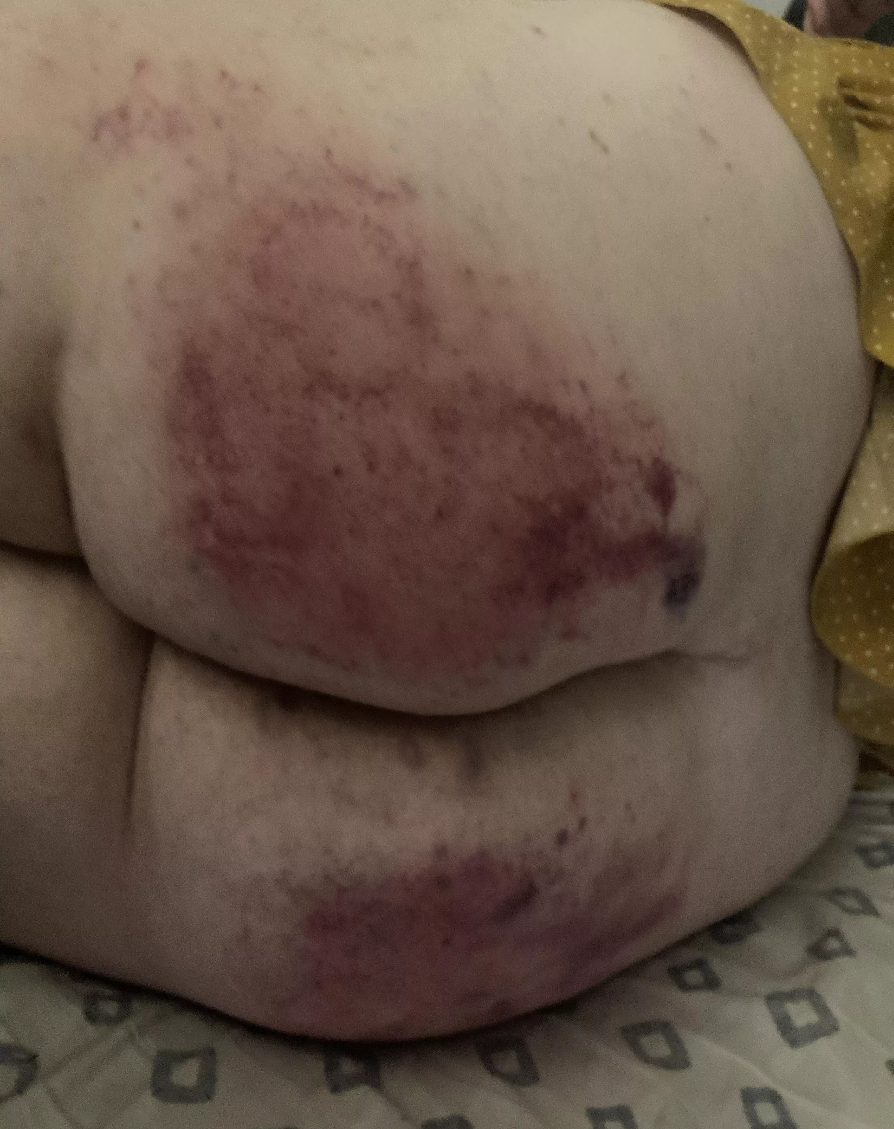 [F] This scene made me cry 🥵