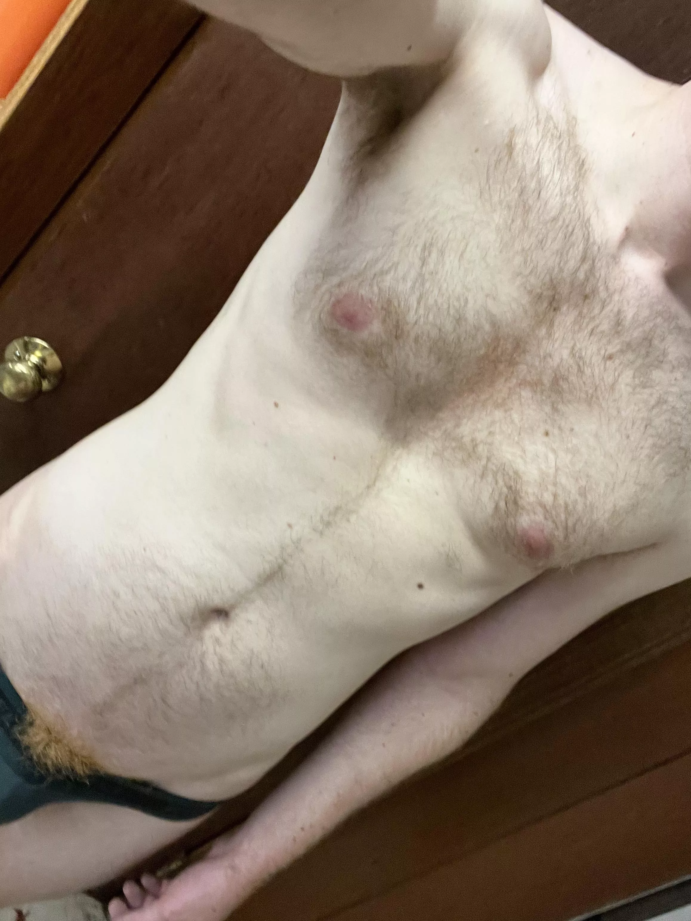 Young, hairy, and ginger