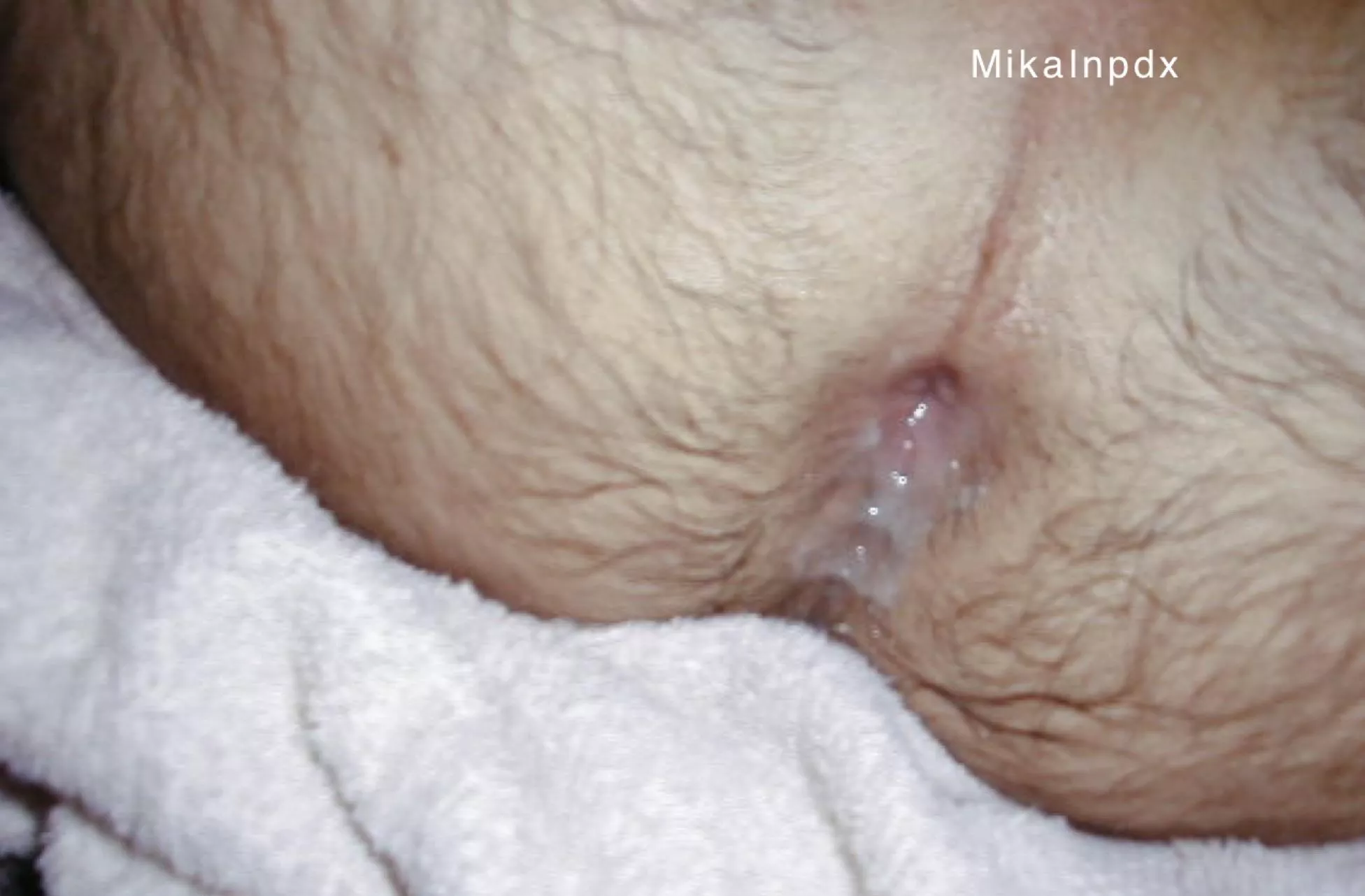 Flashback - After he pulled out