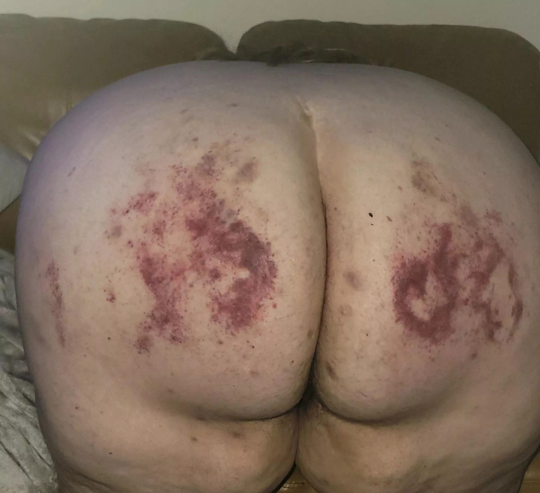 This one really hurt 🤤