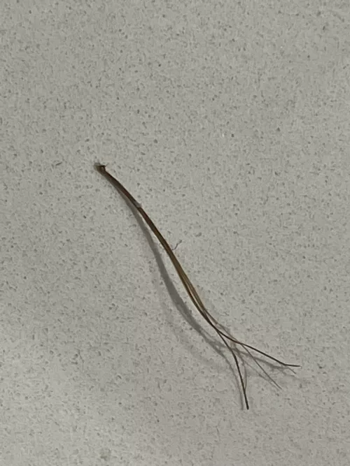 Another pili multigemini extracted from my beard. This one has 2 thicker hairs and a few other really thin ones.