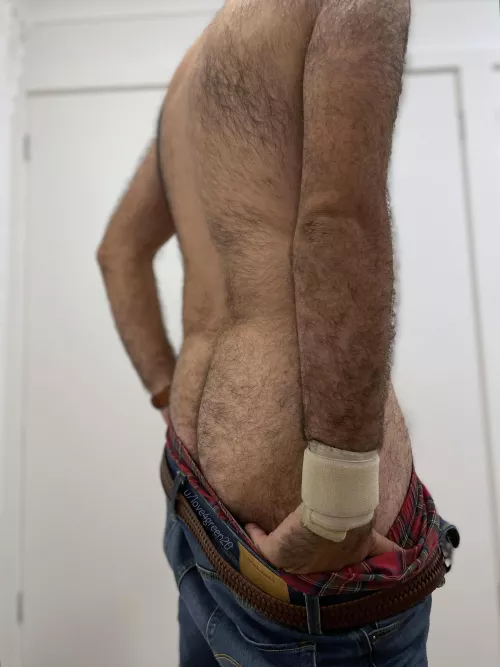 Tis but a butt scratch.