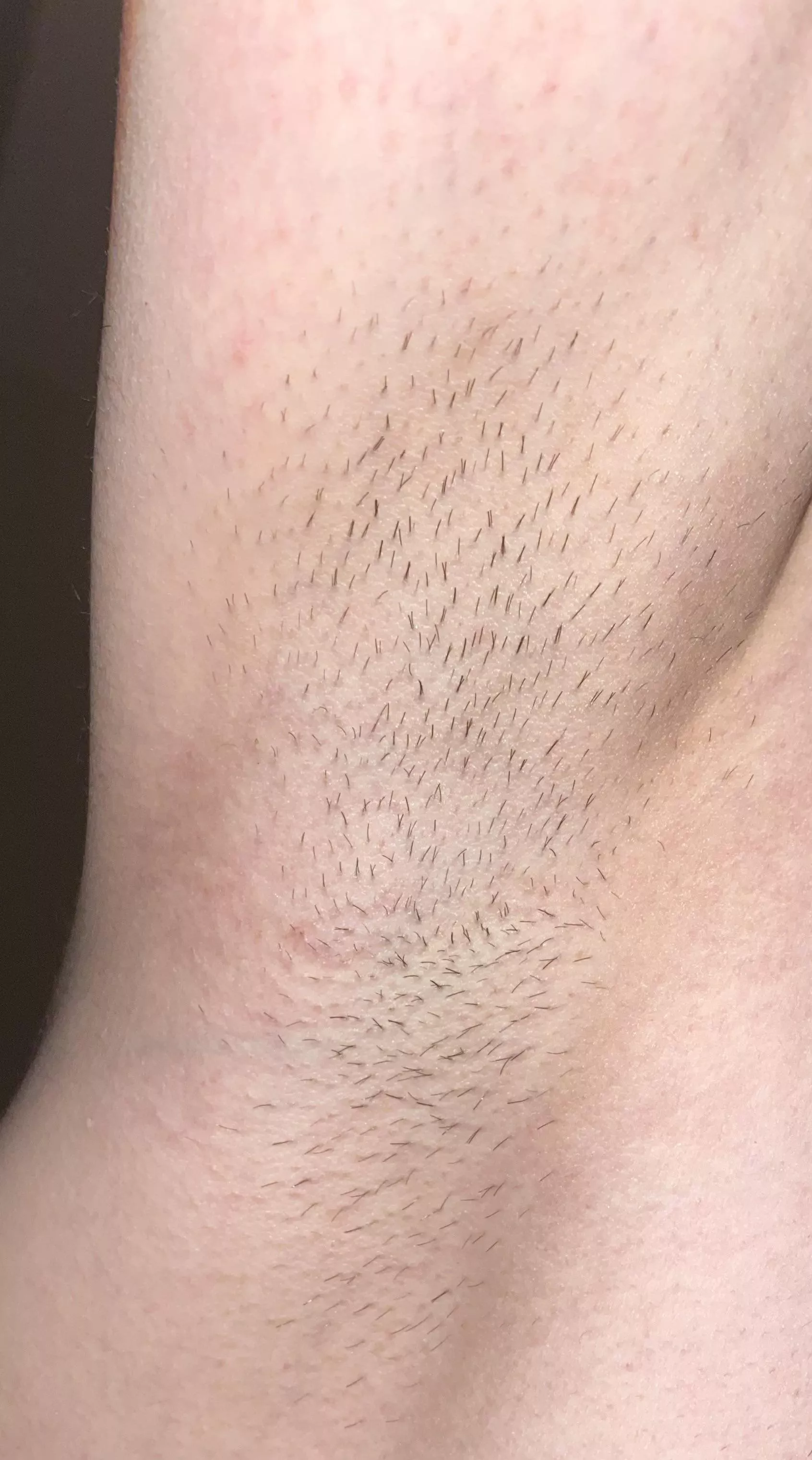 Would you lick them?