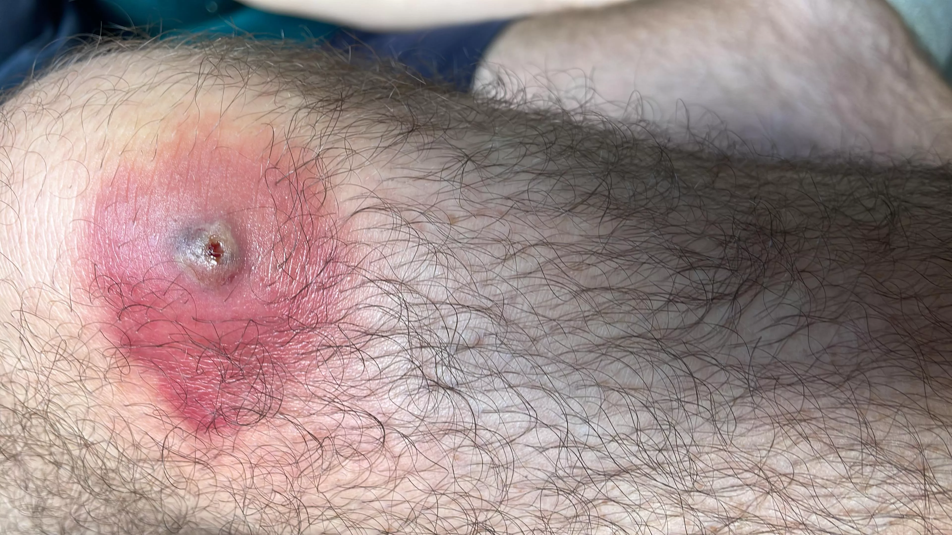 Can’t wait to pop this