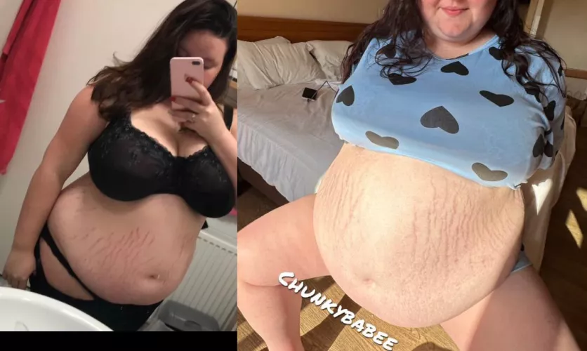 What a year of stuffing my gut did to my stretchmarks..