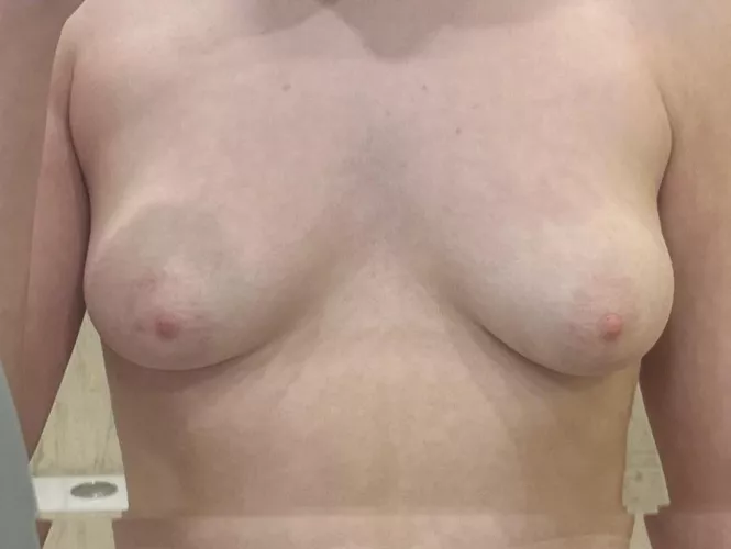 f19, 49kg, 5’1. Are my boobs ugly?