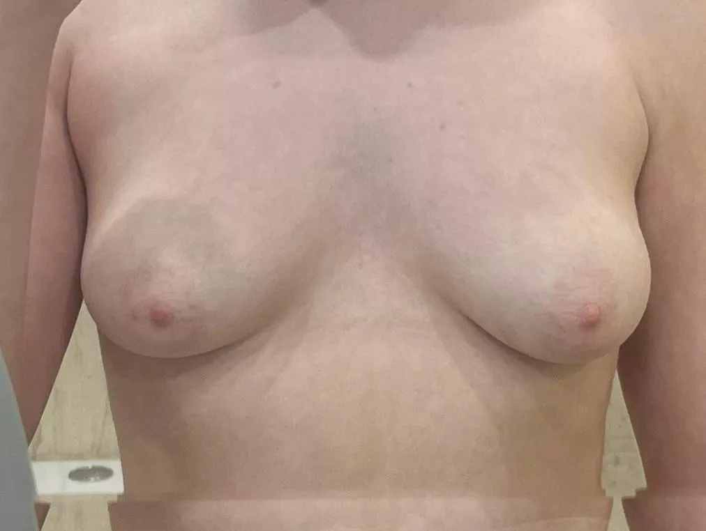 f19, 49kg, 5’1. Are my boobs ugly?