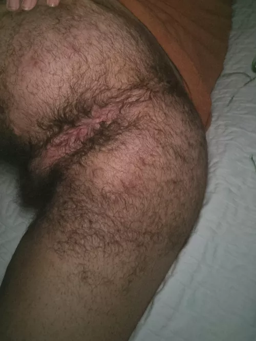 Hairy enough?