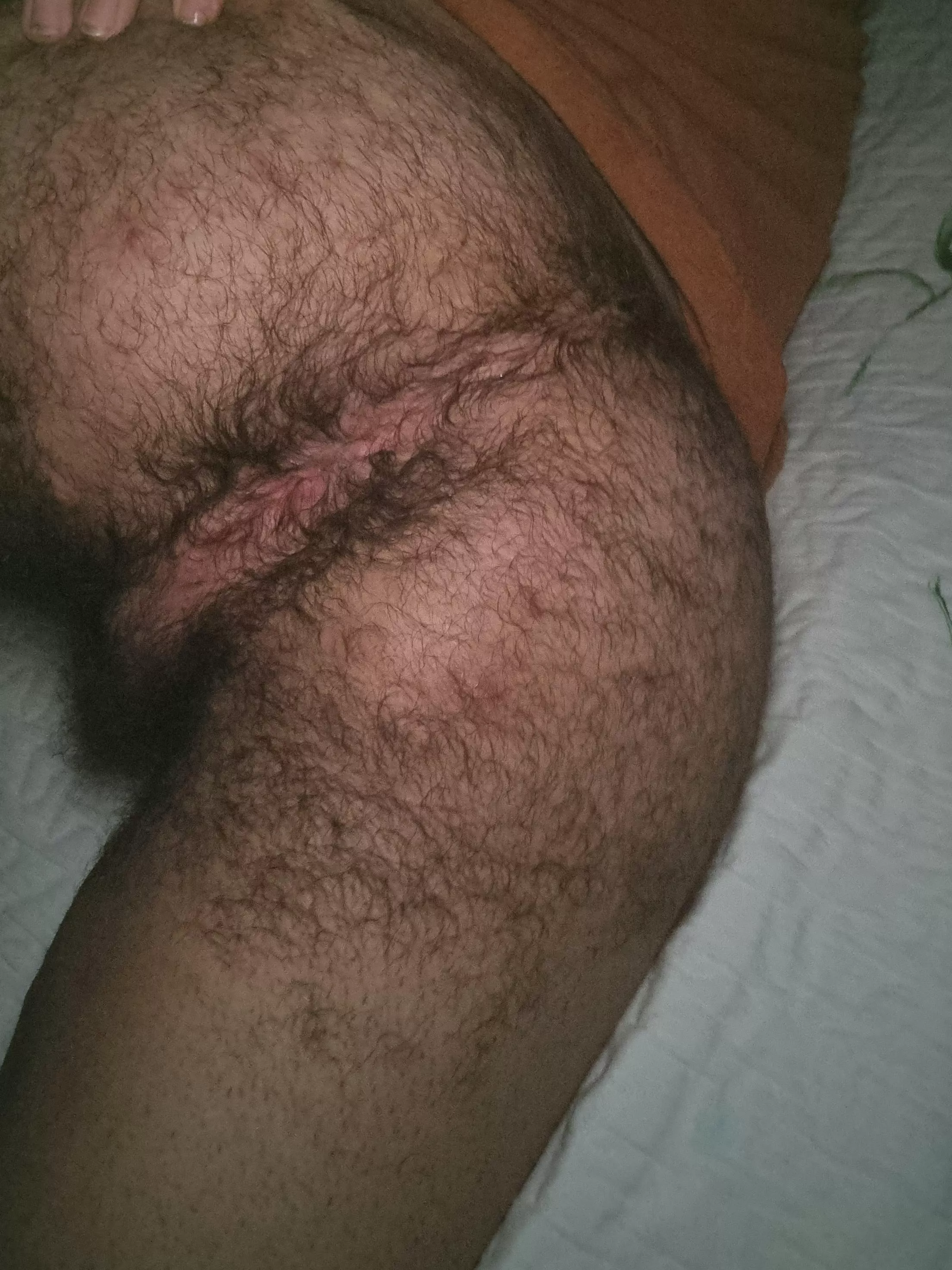 Hairy enough?