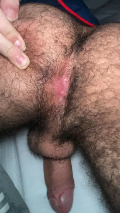 More of my hairy ass