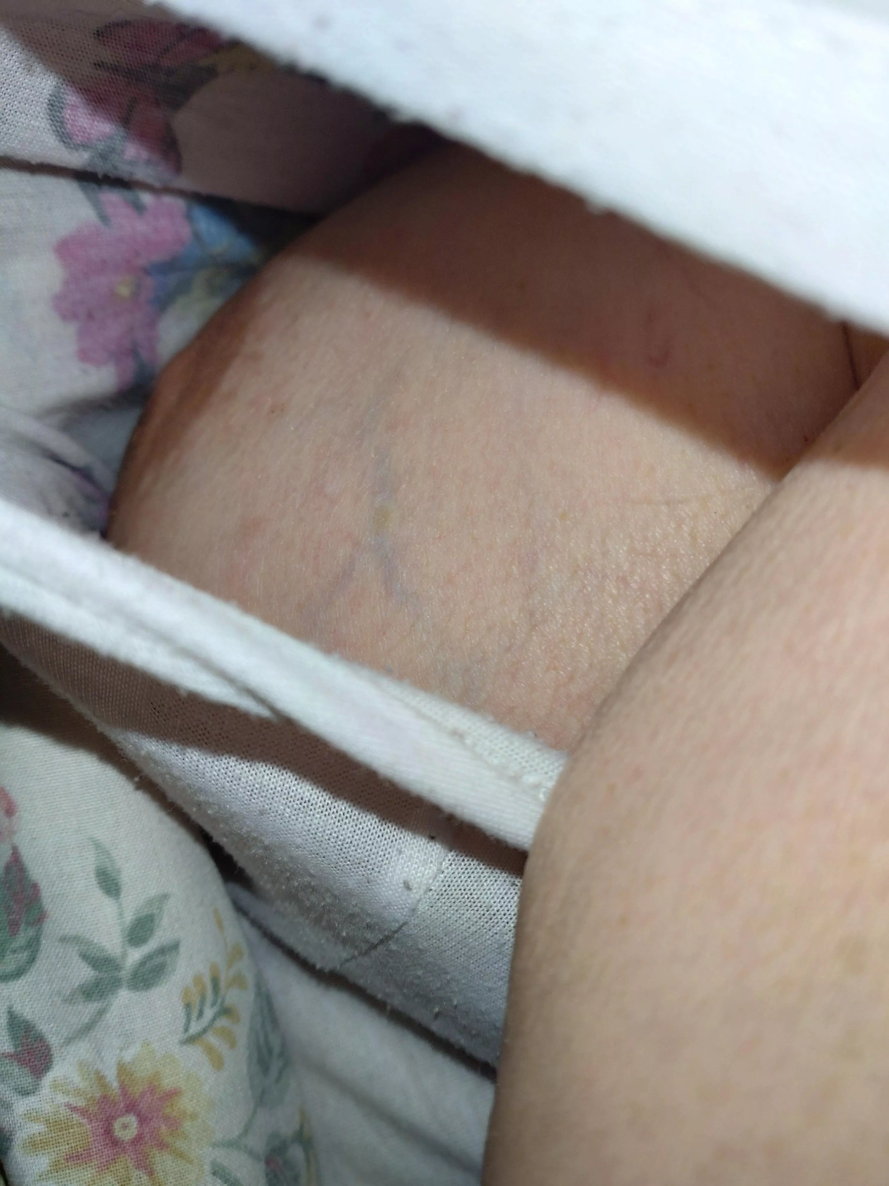 Side boob nipple slip