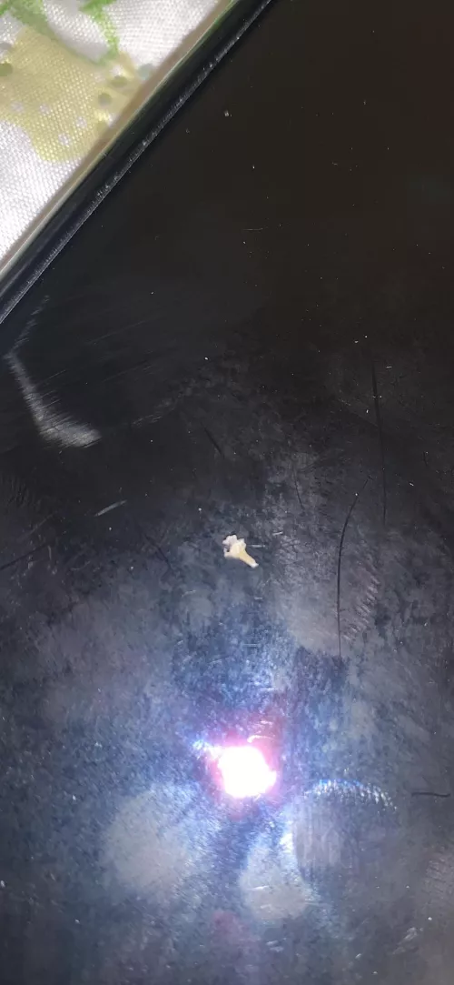 This blackhead that took two of us to pull out of my mom’s back